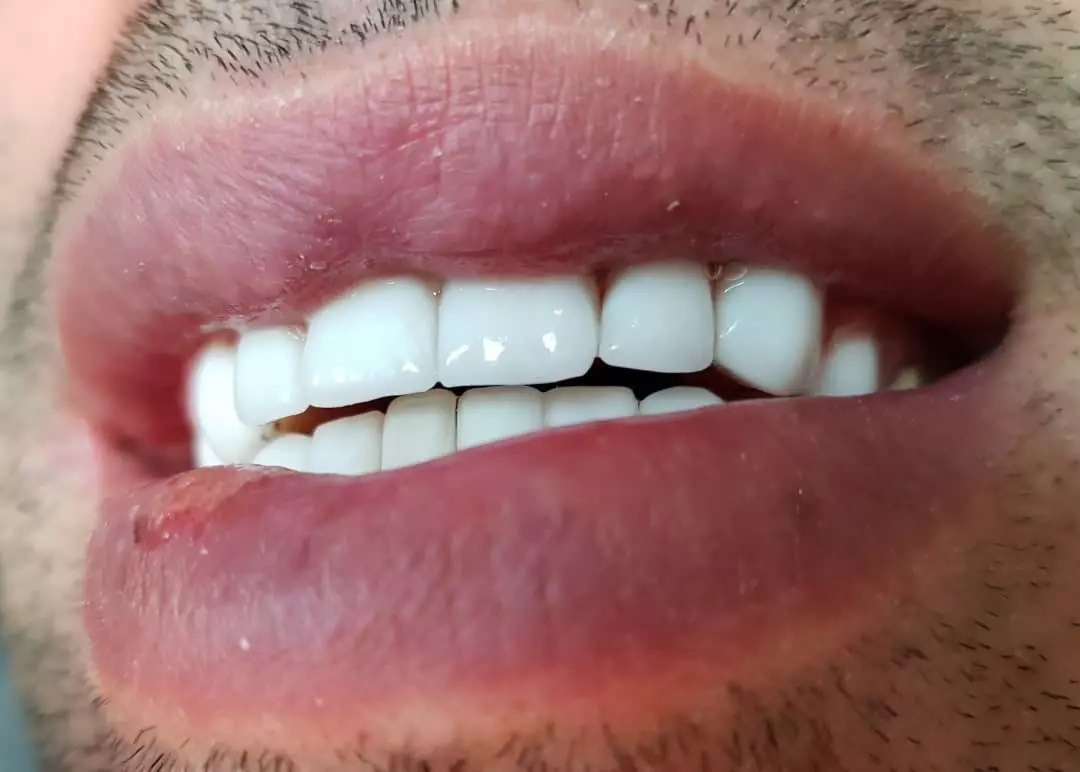 8574837584735