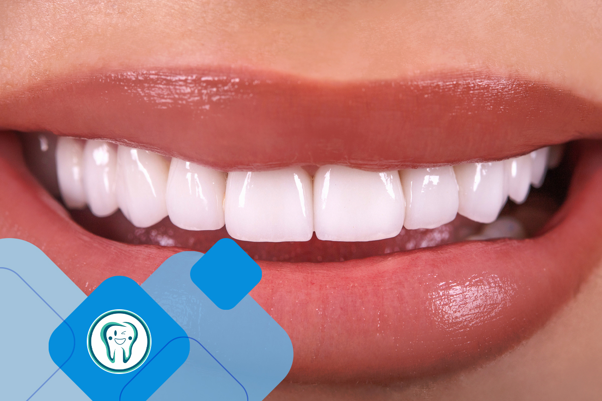 تراش دندان برای روکش سرامیکی