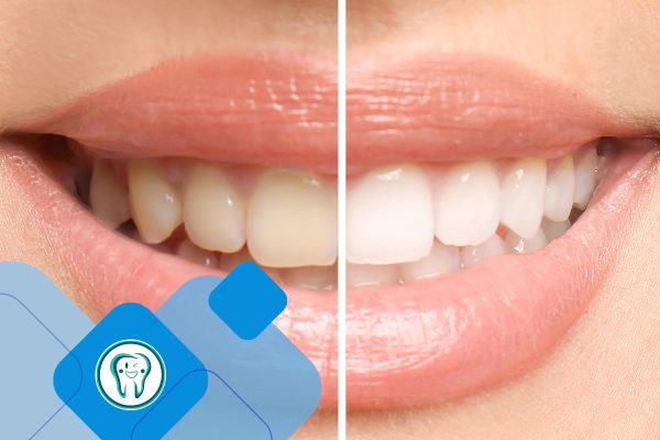 دندانپزشکی زیبایی شهر قدس