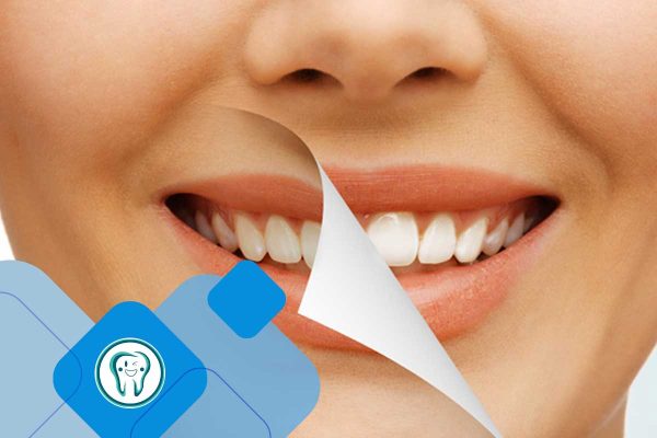 دندانپزشکی زیبایی در شهریار