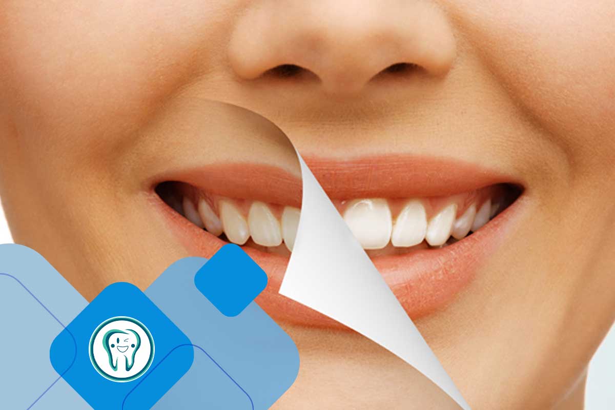 دندانپزشکی زیبایی در شهریار