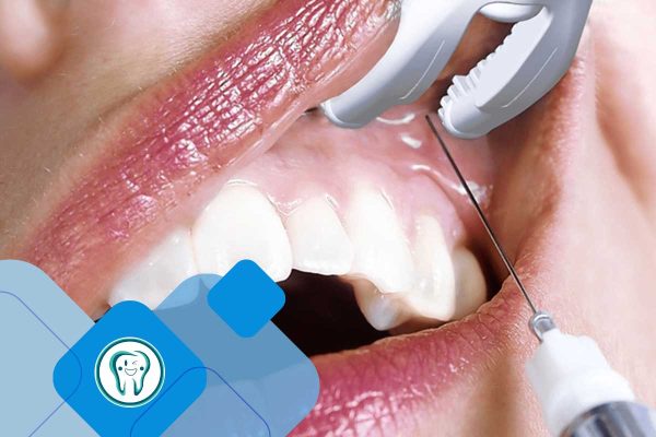 مقالات 83 دگزامتازون برای دندان درد