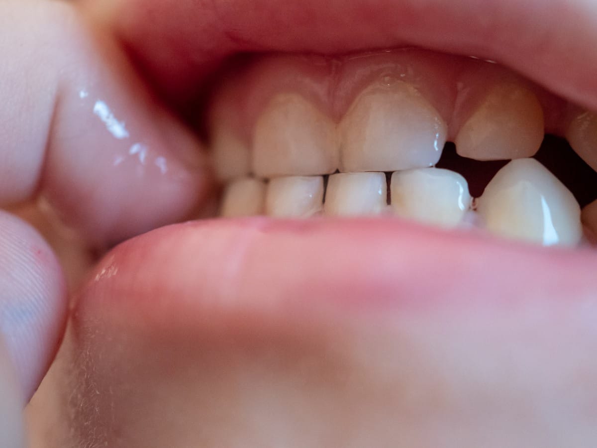 Effects of