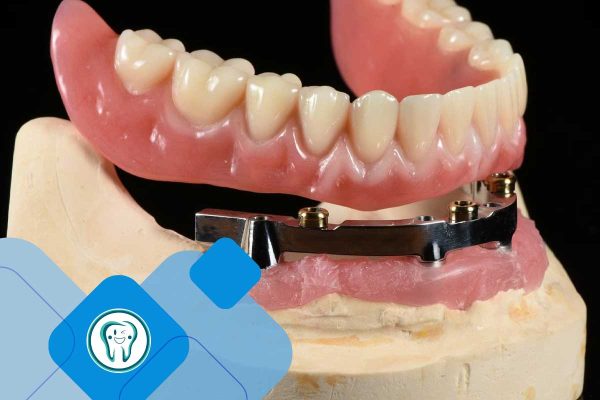 مقالات 69 اوردنچر فک پایین