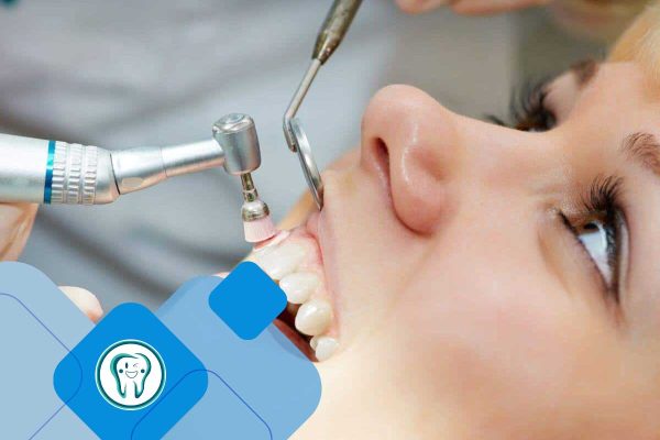 جرم‌گیری و بروساژ دندان در کرج