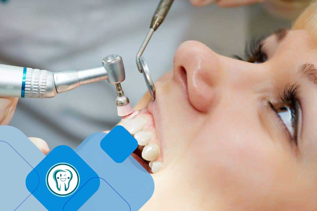 جرم‌گیری و بروساژ دندان در کرج