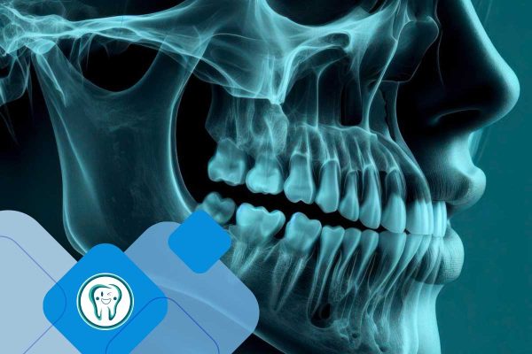 تحلیل استخوان فک پس از کشیدن دندان