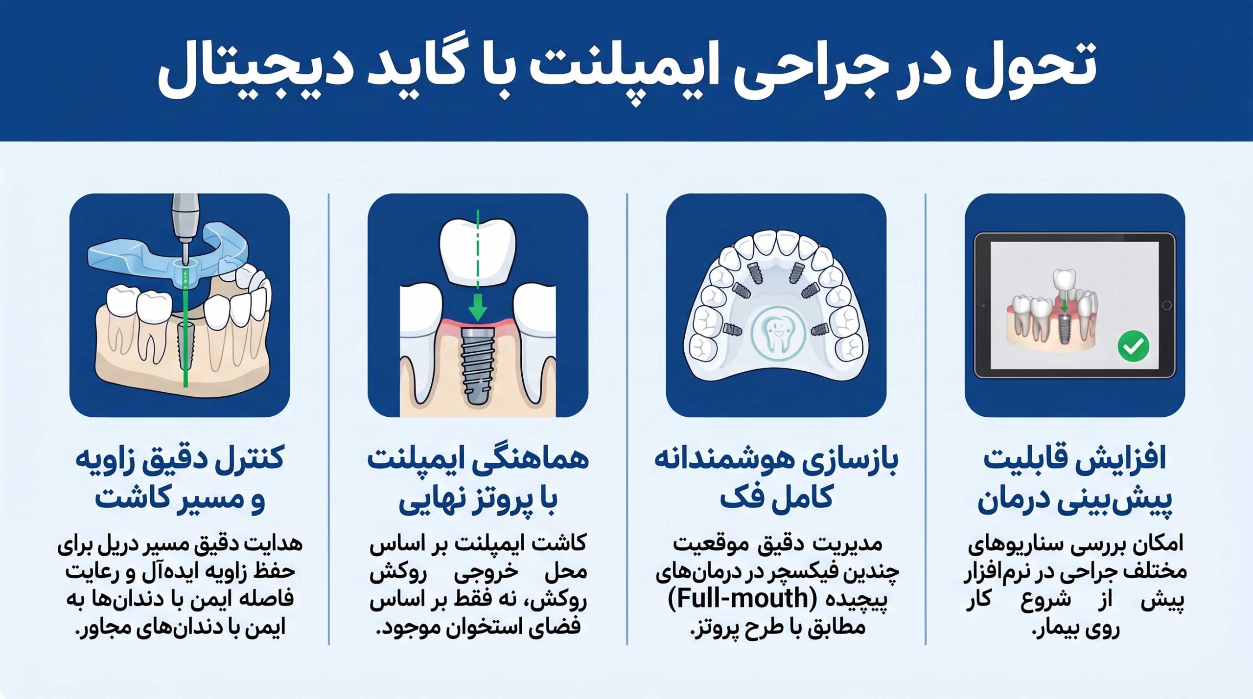 کاربرد های گاید جراحی ایمپلنت دیجیتال