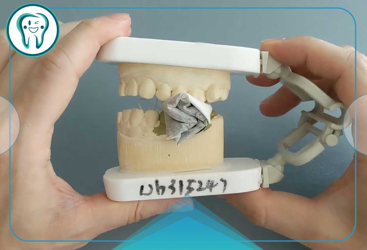 Tea bags for gums