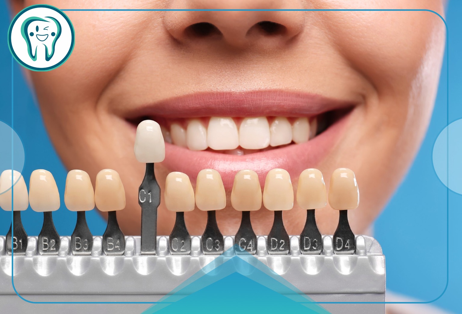 دندانپزشکی اقساطی در شهریار: بهرهمندی از خدمات حرفهای با پرداخت قسطی 3 imageye imgi 23 Dental services in installments