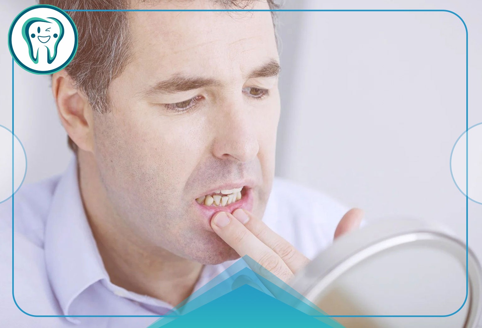 ارتباط خونریزی لثه و سرطان خون: پیشگیری از خونریزی لثه 2 imgi 23 GSD Causes of Bleeding Gums Blog 1