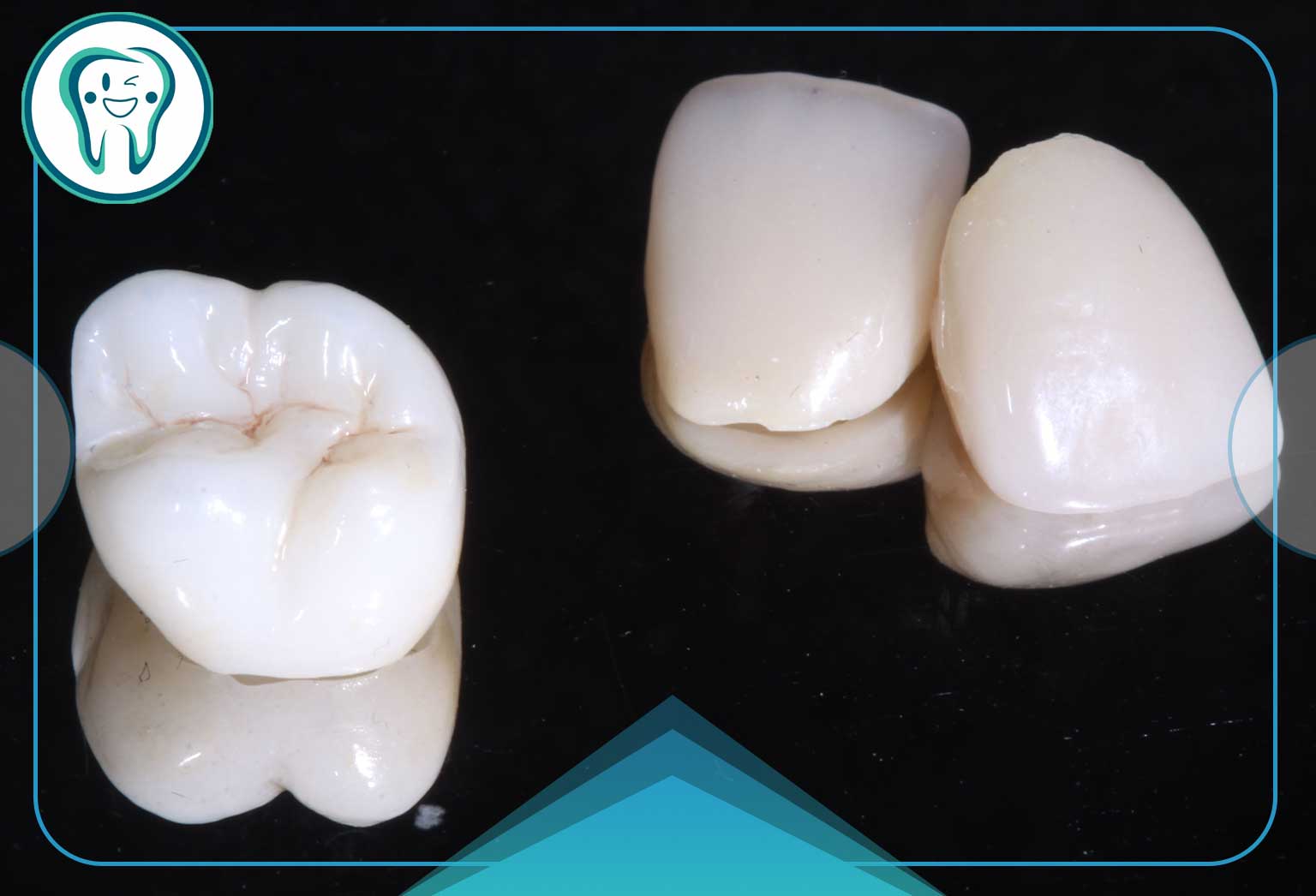 چرا تراش دندان برای روکش سرامیکی ضروری است؟ 2 قالب سایت قدسsccdscdcthrb
