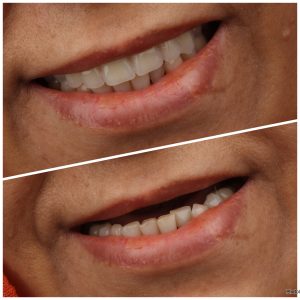 راهنمای کامل انتخاب مطب دندانپزشکی زیبایی در شهریار(دندانپزشکی دکتر محسن بیاتی) 8 created by photogrid