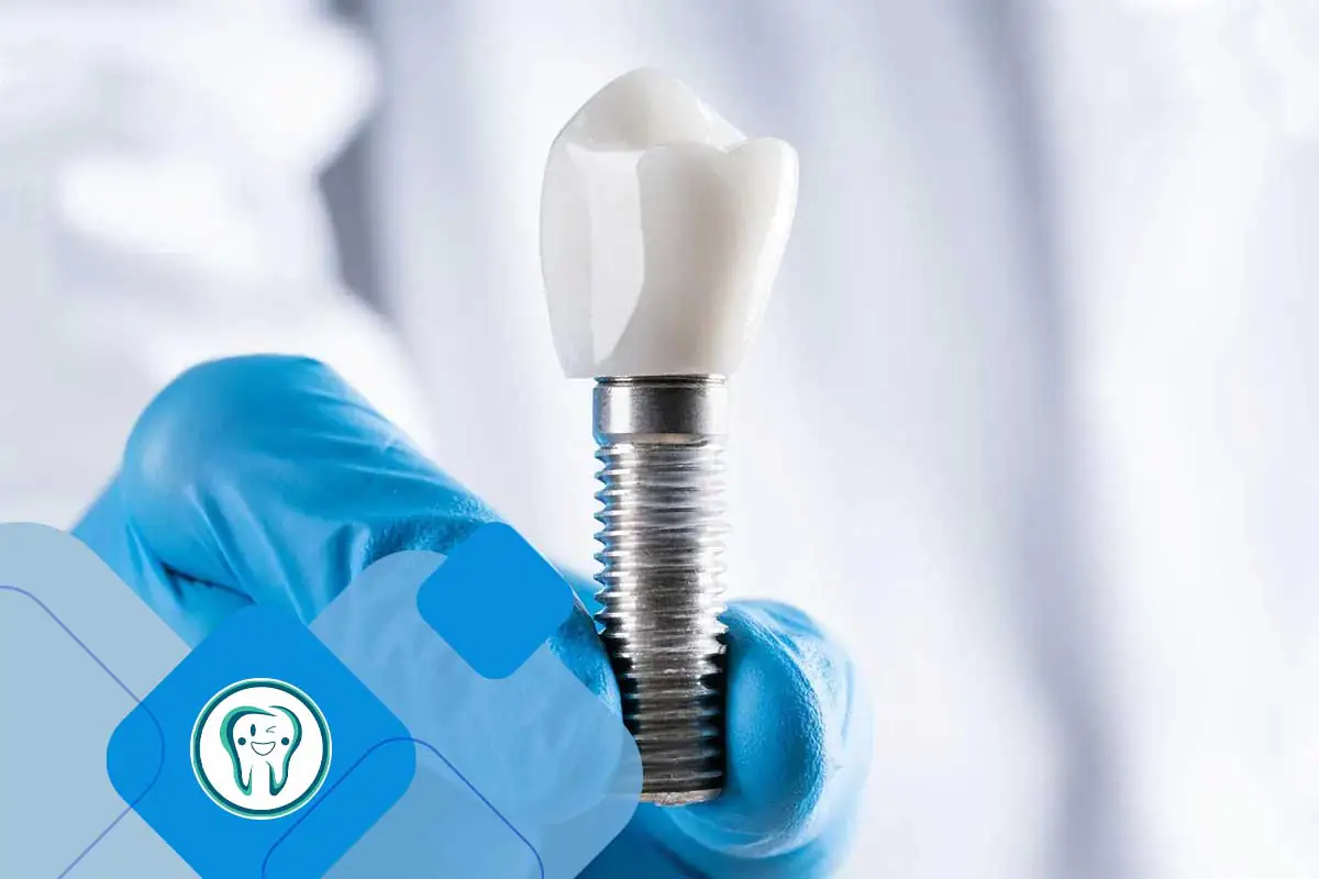 ایمپلنت در افراد دیابتی کرج؛ شرایط کاشت و مراقبتهای ضروری 1 قرار دادن اباتمنت