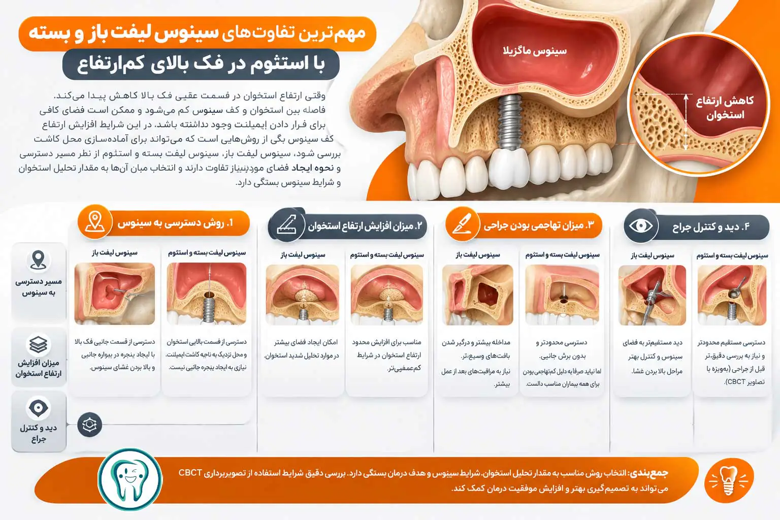 تفاوت سینوس لیفت باز و بسته با استئوم در فک بالای کم ارتفاع 1 مهمترین تفاوتهای سینوس لیفت باز و بسته با استئوم در فک بالای کمارتفاع