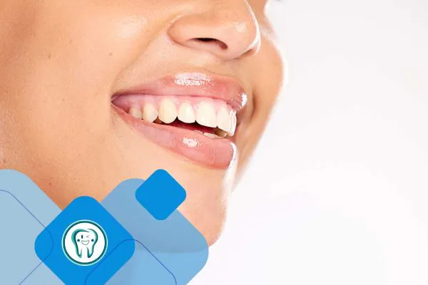 کلینیک تخصصی دندانپزشکی دکتر محسن بیاتی 35 اصلاح لبخند لثه ای با لیزر